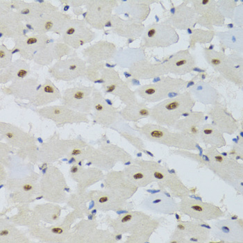 DDB1 Rabbit polyclonal antibody