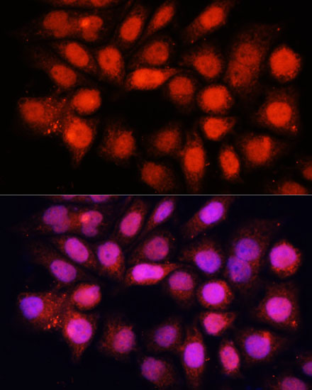 DDB1 Rabbit polyclonal antibody
