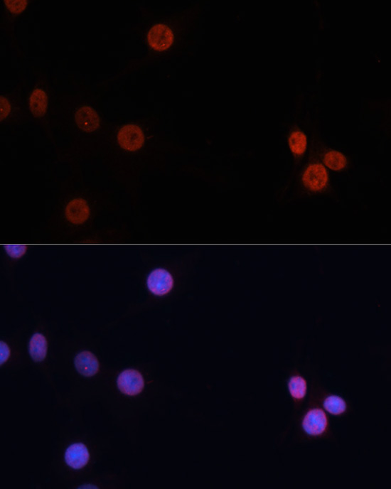 DNMT3B Rabbit polyclonal antibody