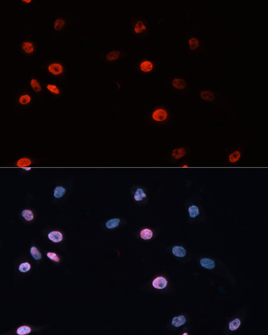 DNMT3B Rabbit polyclonal antibody