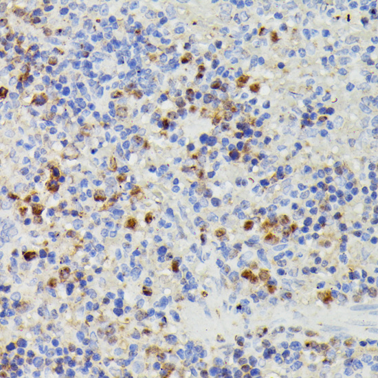 DUT Rabbit polyclonal antibody