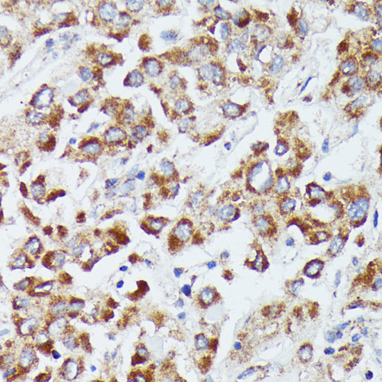DUT Rabbit polyclonal antibody