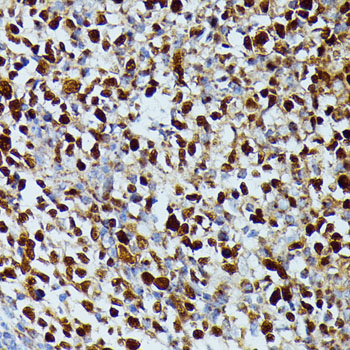 DUT Rabbit polyclonal antibody