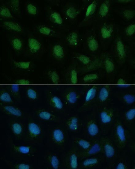 DUT Rabbit polyclonal antibody