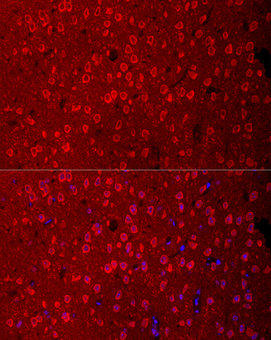 SLC1A1 Rabbit polyclonal antibody