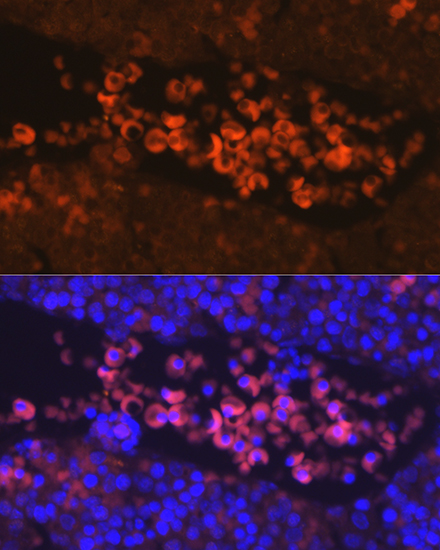EPOR Rabbit polyclonal antibody