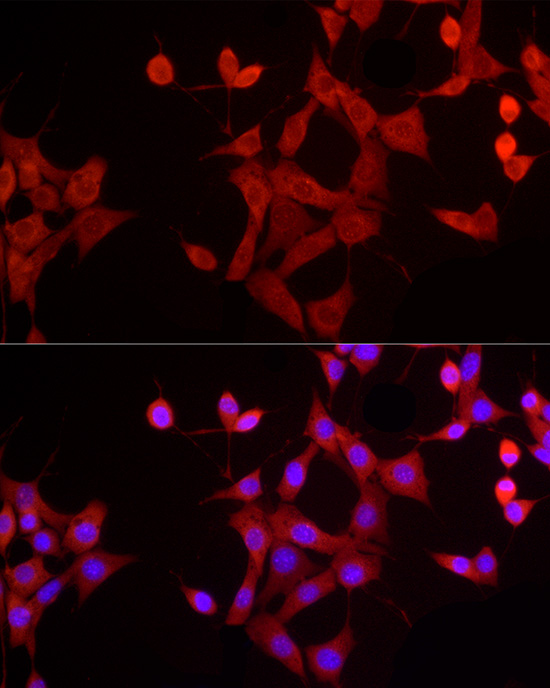 EPOR Rabbit polyclonal antibody