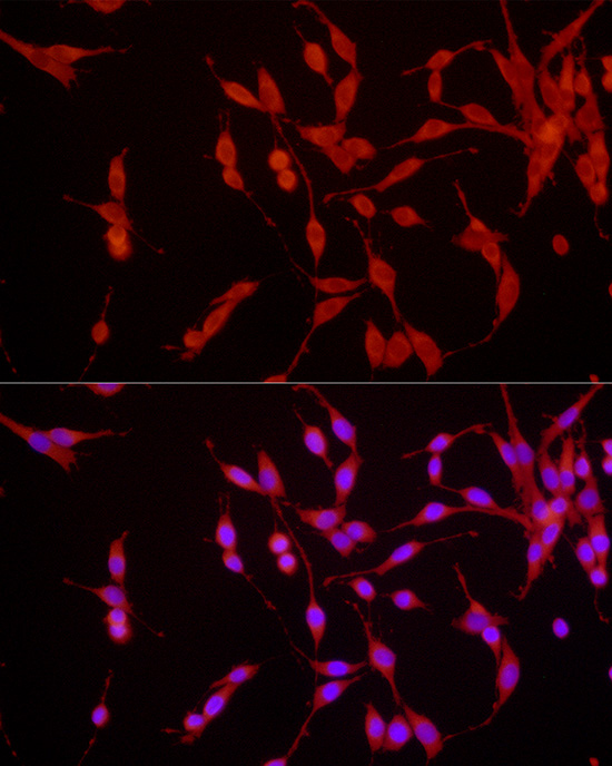 EPOR Rabbit polyclonal antibody