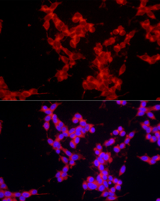EPOR Rabbit polyclonal antibody