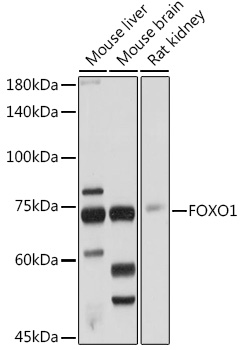 FOXO1 Rabbit polyclonal antibody