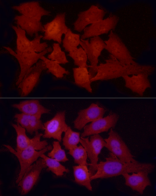 FOXO1 Rabbit polyclonal antibody