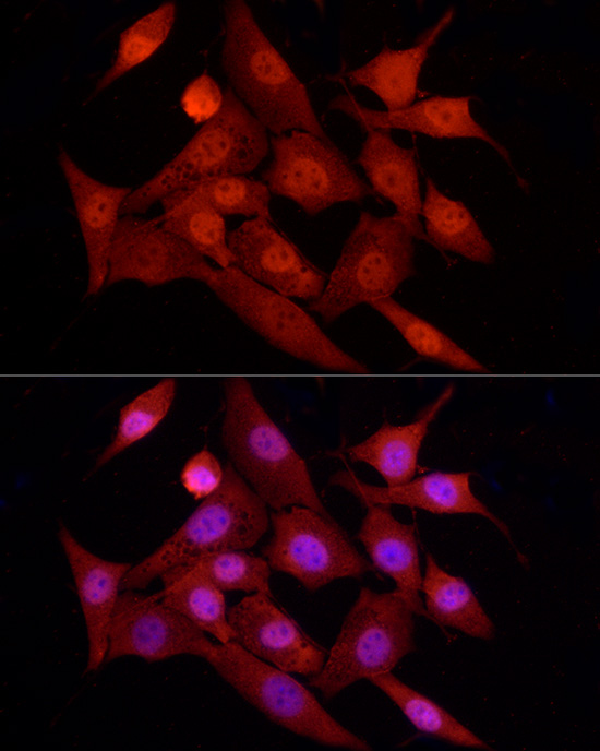 FOXO1 Rabbit polyclonal antibody