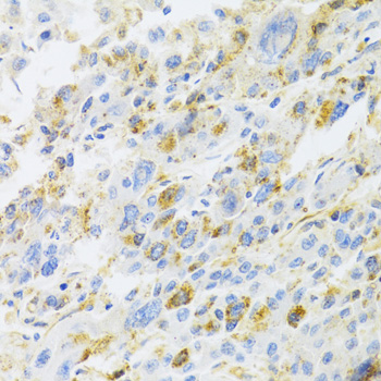 CXCR3 Rabbit polyclonal antibody