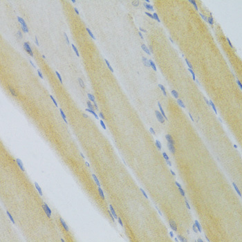 CXCR3 Rabbit polyclonal antibody