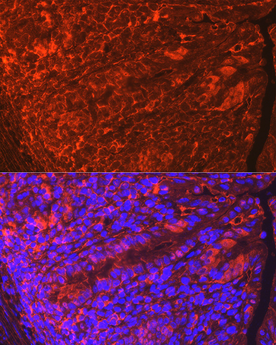 CLDN3 Rabbit polyclonal antibody