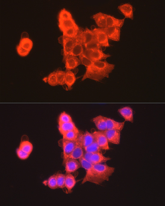 CLDN3 Rabbit polyclonal antibody