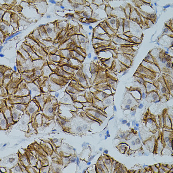 CLDN3 Rabbit polyclonal antibody