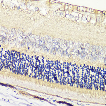 GRK1 Rabbit polyclonal antibody