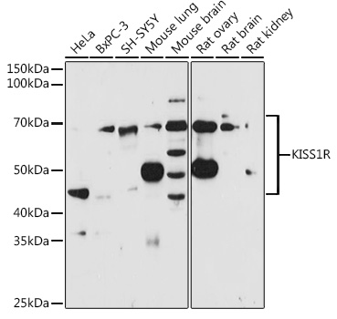 KISS1R Rabbit polyclonal antibody