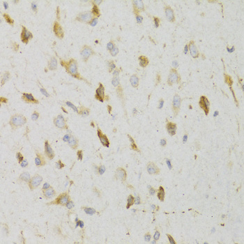 KISS1R Rabbit polyclonal antibody