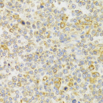KISS1R Rabbit polyclonal antibody