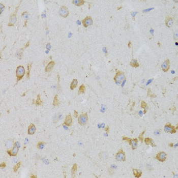 KISS1R Rabbit polyclonal antibody
