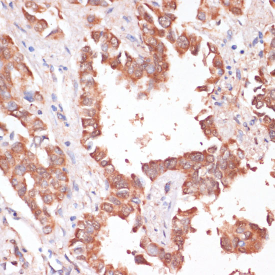 KCNH2 Rabbit polyclonal antibody