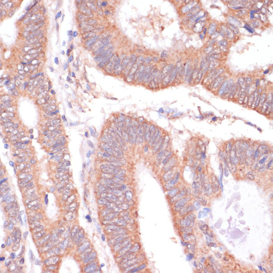 KCNH2 Rabbit polyclonal antibody