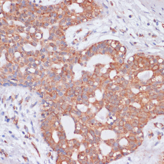 KCNH2 Rabbit polyclonal antibody