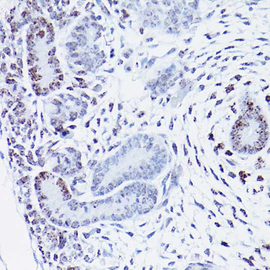 HMGA2 Rabbit polyclonal antibody