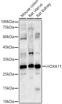 HOXA11 Rabbit polyclonal antibody