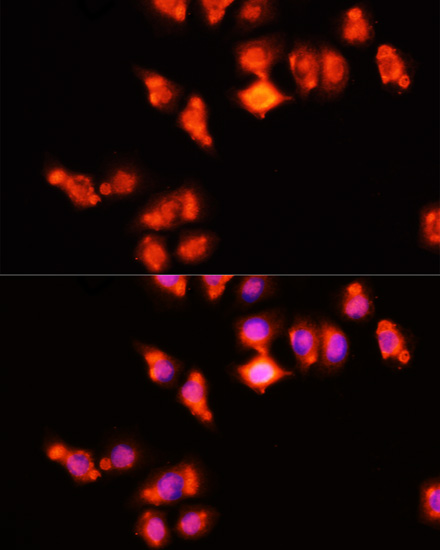 HOXA11 Rabbit polyclonal antibody
