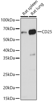 CD25 Rabbit polyclonal antibody