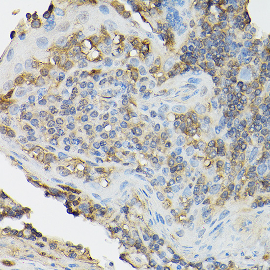 CD25 Rabbit polyclonal antibody