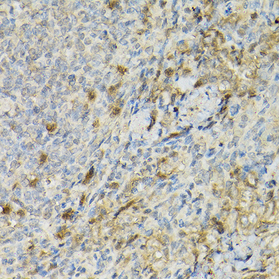 CD25 Rabbit polyclonal antibody