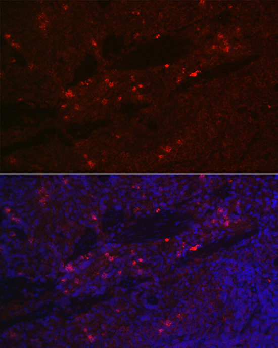 CD25 Rabbit polyclonal antibody