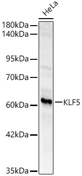 KLF5 Rabbit polyclonal antibody