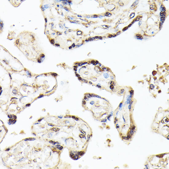 KLF5 Rabbit polyclonal antibody