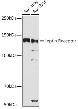 Leptin Receptor Rabbit polyclonal antibody