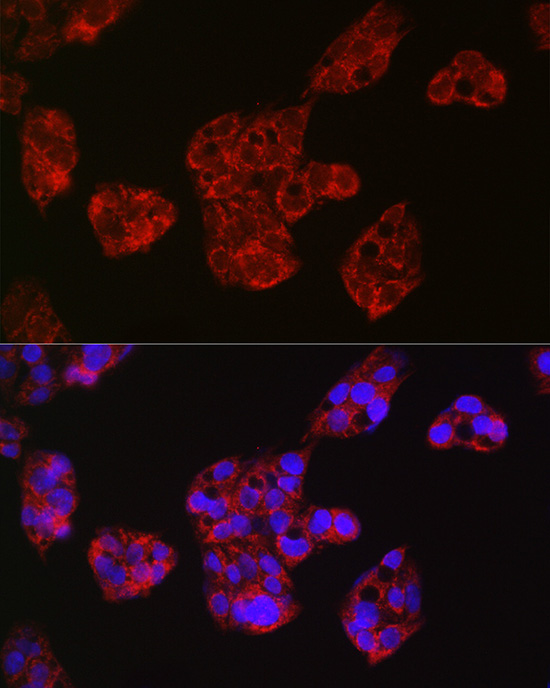 Leptin Receptor Rabbit polyclonal antibody