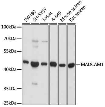 MADCAM1 Rabbit polyclonal antibody