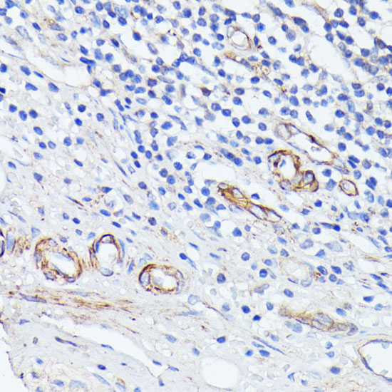 MADCAM1 Rabbit polyclonal antibody