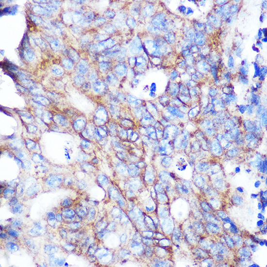 Flotillin 1 Rabbit monoclonal antibody
