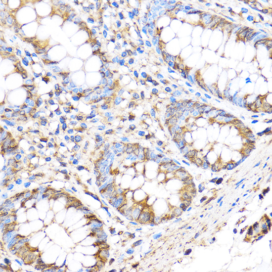 MMP17 Rabbit polyclonal antibody