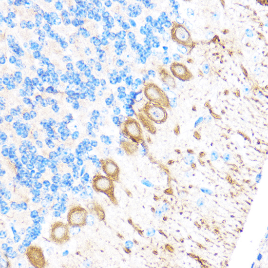 MMP17 Rabbit polyclonal antibody