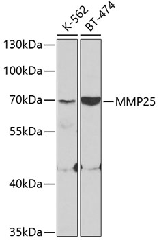 MMP25 Rabbit polyclonal antibody