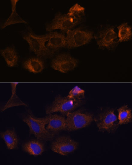 MMP25 Rabbit polyclonal antibody