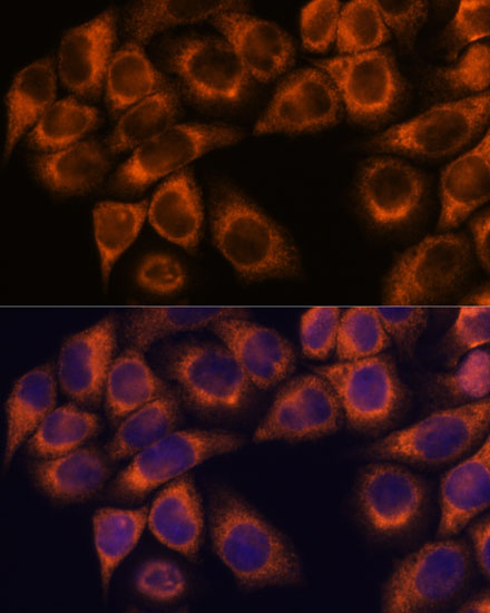 MMP25 Rabbit polyclonal antibody