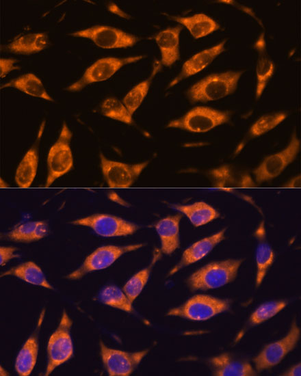 MMP25 Rabbit polyclonal antibody