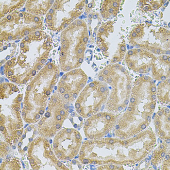 MMP10 Rabbit polyclonal antibody